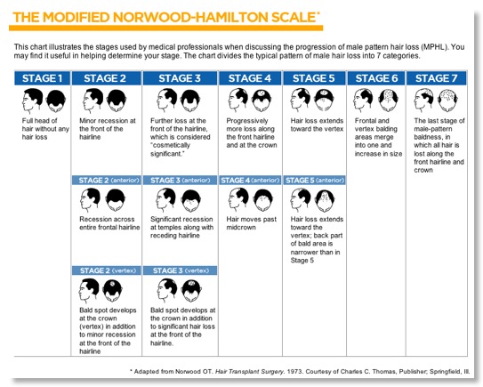 Norwood-Hamilton scale of male hair loss.